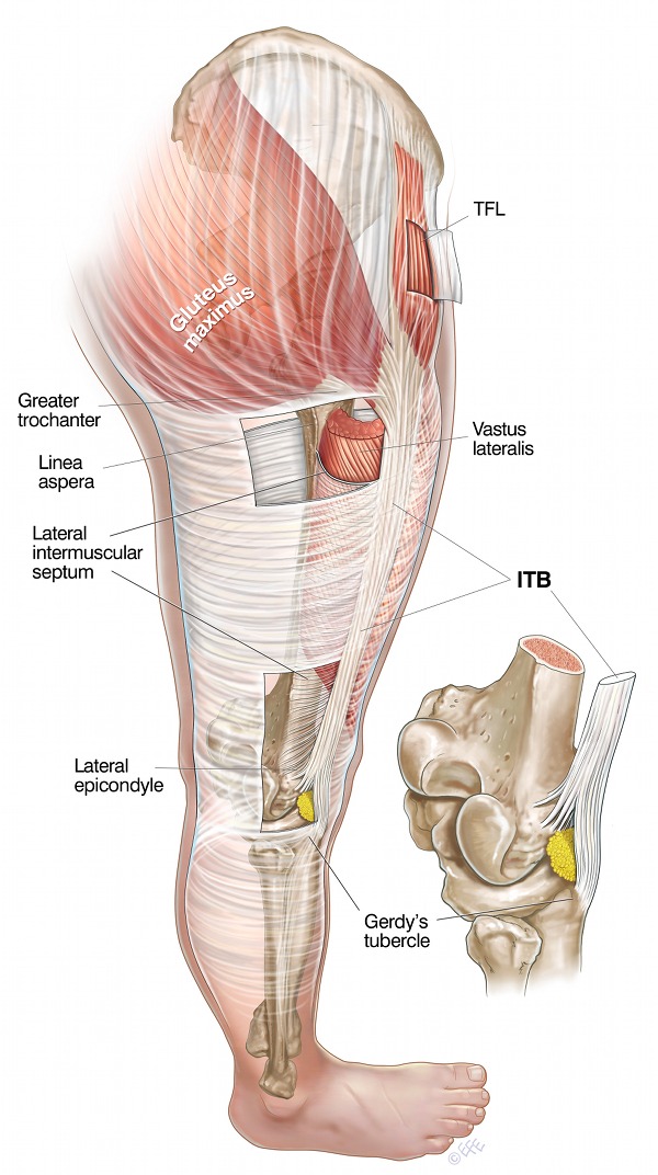 what causes itb syndrome?