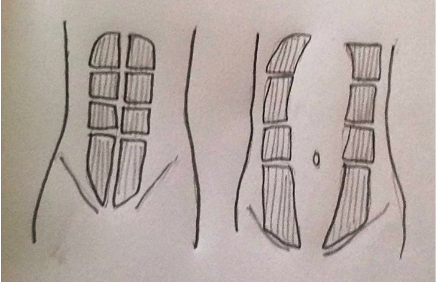 Returning to Exercise after Childbirth [Part 1]