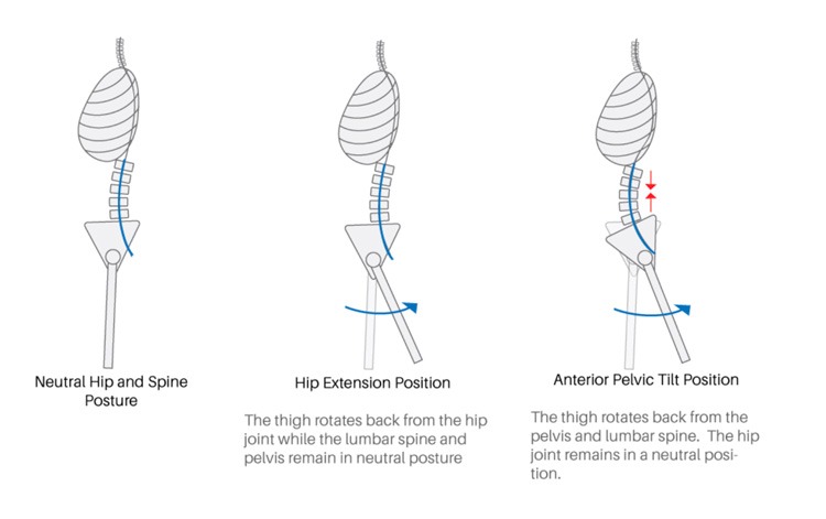 Anterior pelvic tilt while running showing the effect on glute engagement