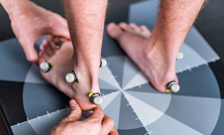 Podiatrist preparing the foot for a gait assessment. Pronation and supination will be measured dynamically.