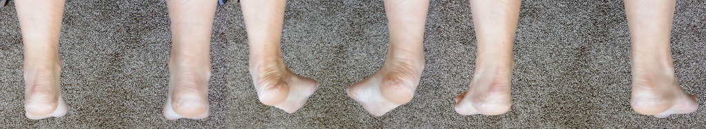 Are You at Risk of Stress Fractures? [Video]